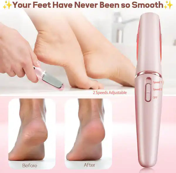 Electric Foot Dirt Remover - Unisex China Made